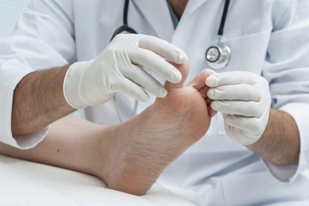 foot fungus diagnosis by a doctor